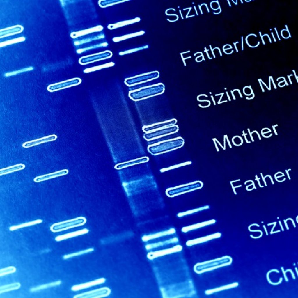 Study unravels hypertrophic cardiomyopathy cases in Finland